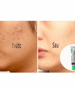 vn 11134207 7qukw lf93jo6ho6mi0d