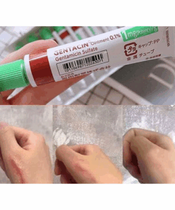 Alternative view of Kem giảm Sẹo Gentacin Ointment 0.1% Nhật Bản: Bí quyết hỗ trợ cải thiện các vết sẹo