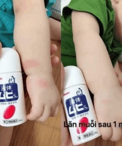 Bôi muỗi dạng lăn Muhi 50ml ngăn ngừa muỗi đốt và côn trùng cắn giảm sưng , ngứa 12 vn 11134207 7qukw lfap1efgy05z1b