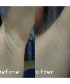 Alternative view of Xà Phòng Giảm Thâm Nách nội địa Nhật Bản