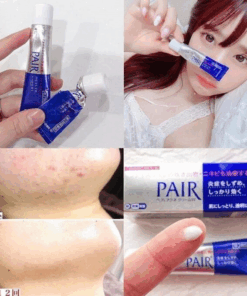 Alternative view of Kem trị mụn Pair (24g) – Hỗ trợ giảm mụn giảm thâm từ Nhật Bản